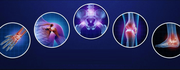 Orthopaedic